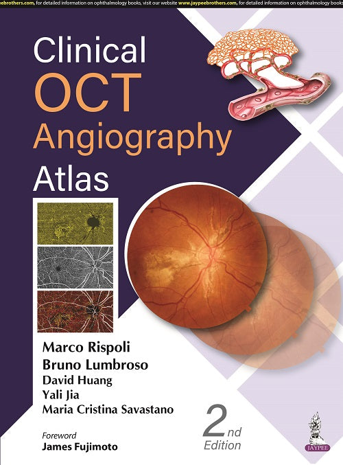 CLINICAL OCT ANGIOGRAPHY ATLAS 2/E, 2022, MARCO RISPOLI