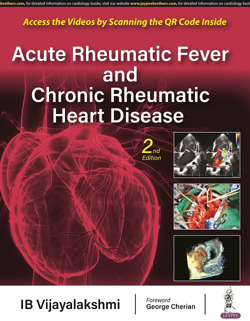 ACUTE RHEUMATIC FEVER AND CHRONIC RHEUMATIC HEART DISEASE 2/E, 2023, IB VIJAYALAKSHMI