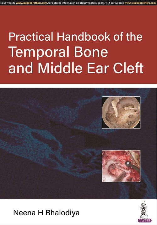 PRACTICAL HANDBOOK OF THE TEMPORAL BONE AND MIDDLE EAR CLEFT 1/E R.P., 2025, NEENA H BHALODIYA