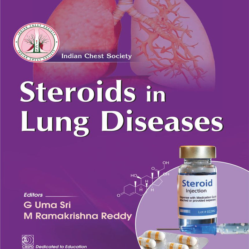 Steroids in lung diseases 1st/2025 by G Uma Sri,M Ramakrishna Reddy