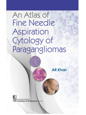 An Atlas of Fine Needle Aspiration Cytology of Paragangliomas 1st/2024 by AR Khan