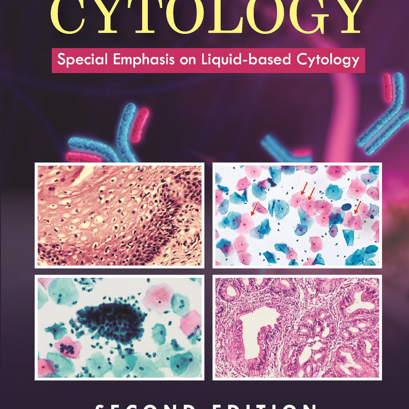 CERVICAL CYTOLOGY: SPECIAL EMPHASIS ON LIQUID-BASED CYTOLOGY 2/E, 2024, PRANAB DEY