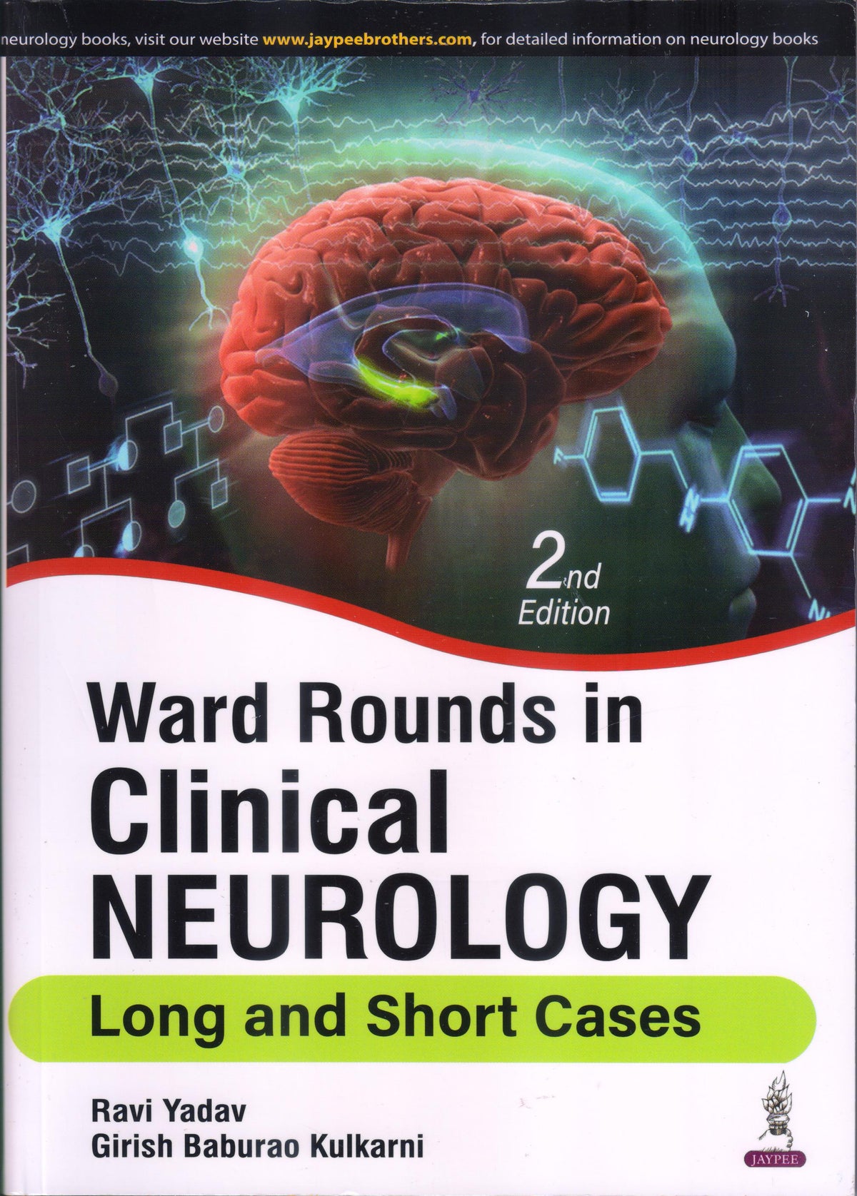 Ward Rounds in Clinical Neurology 2nd/2024 by Ravi Yadav