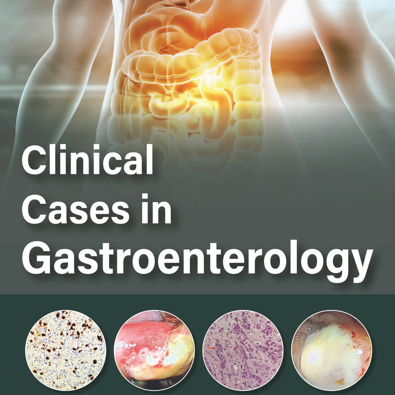 CLINICAL CASES IN GASTROENTEROLOGY 1/E, 2024, RAJESH UPADHYAY