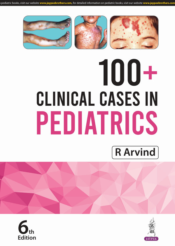 R ARVIND, 100+ CLINICAL CASES IN PEDIATRICS, 6/E, 9789356965720