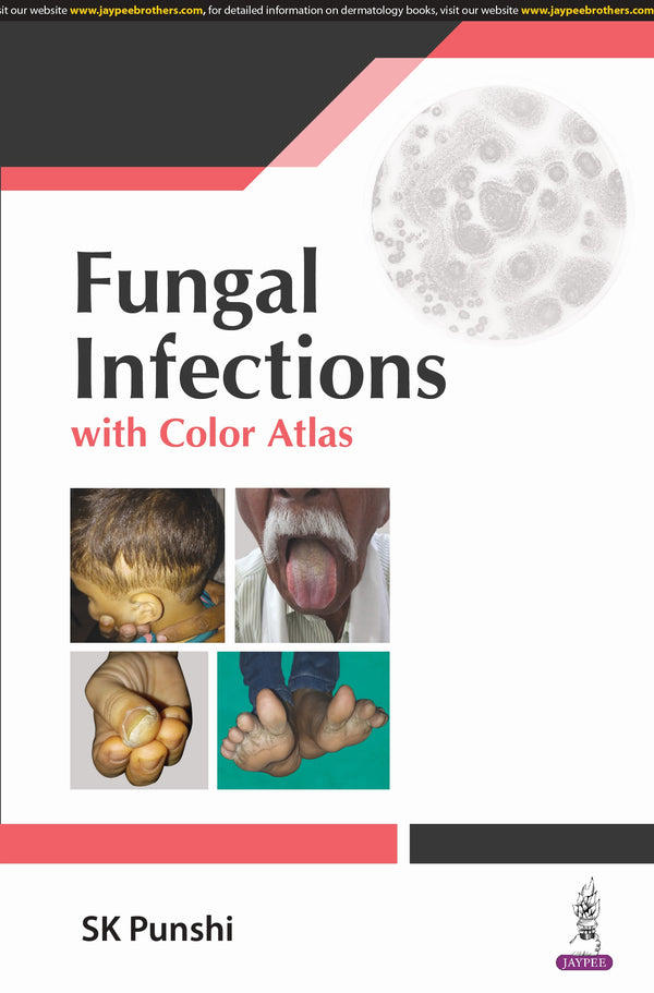 Fungal infections with Color Atlas 1st/2024 by SK Punshi