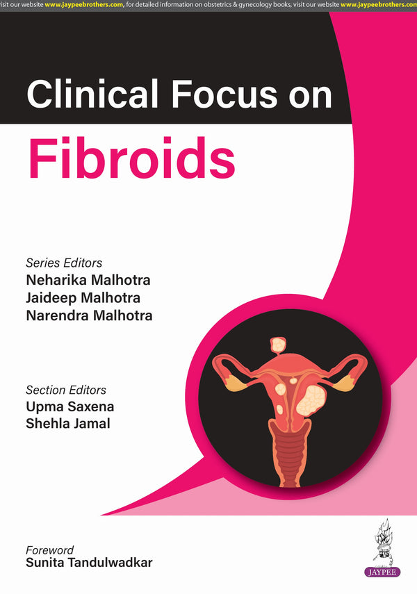 NEHARIKA MALHOTRA, CLINICAL FOCUS ON FIBROIDS, 1/E, 9789356966314