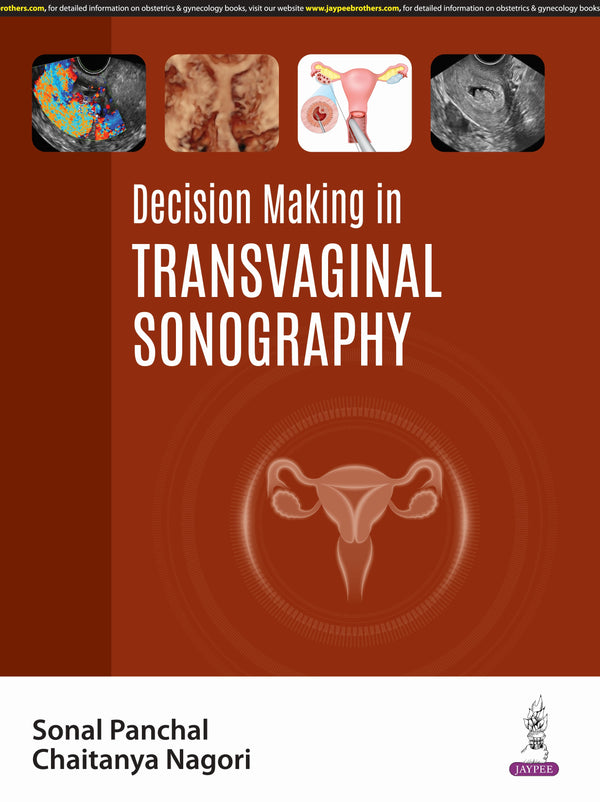 DECISION MAKING IN TRANSVAGINAL SONOGRAPHY 1/E, 2025, SONAL PANCHAL