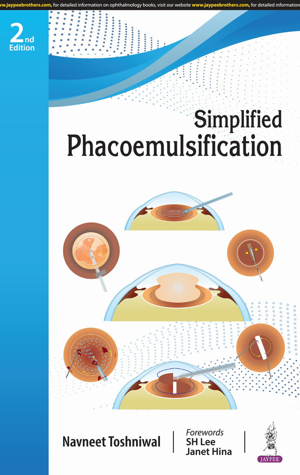 NAVNEET TOSHNIWAL, SIMPLIFIED PHACOEMULSIFICATION, 2/E, 9789356967380