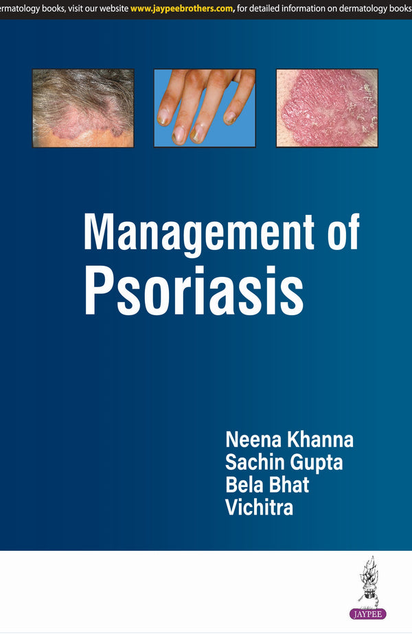 MANAGEMENT OF PSORIASIS 1/E, 2025, NEENA KHANNA