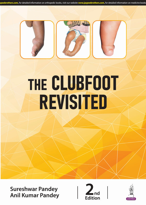 SURESHWAR PANDEY, THE CLUBFOOT REVISITED, 2/E, 9789356967731