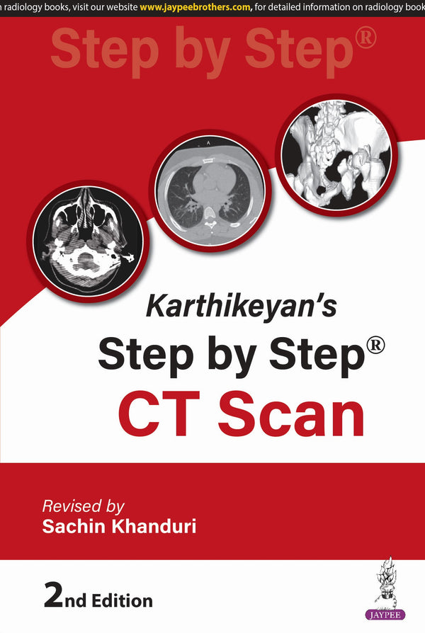 SACHIN KHANDURI, KARTHIKEYAN'S STEP BY STEP CT SCAN, 2/E, 9789366161105