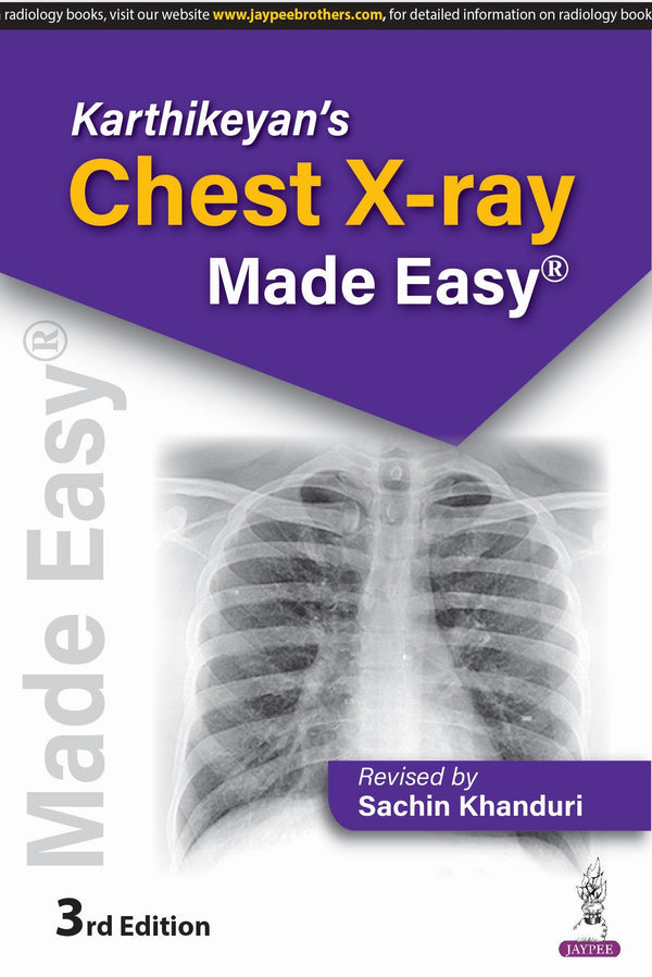 SACHIN KHANDURI, KARTHIKEYAN'S CHEST X-RAY MADE EASY, 3/E, 9789366162737