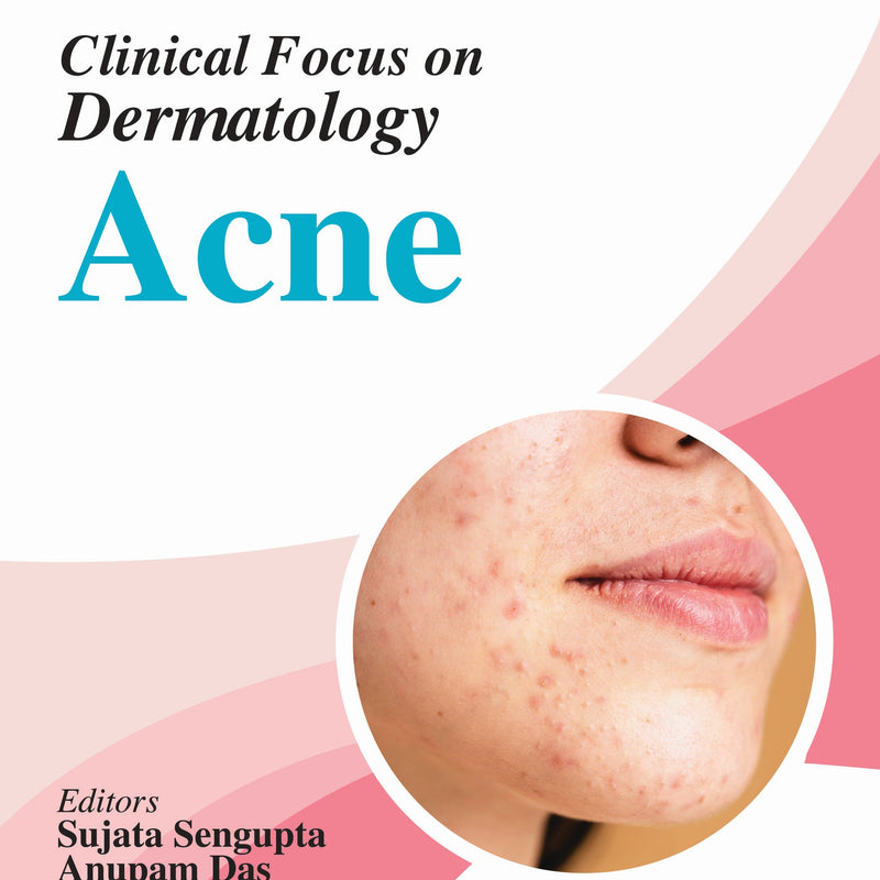 CLINICAL FOCUS ON DERMATOLOGY ACNE 1/E, 2025, SUJATA SENGUPTA