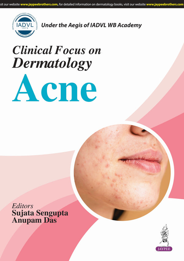 CLINICAL FOCUS ON DERMATOLOGY ACNE 1/E, 2025, SUJATA SENGUPTA