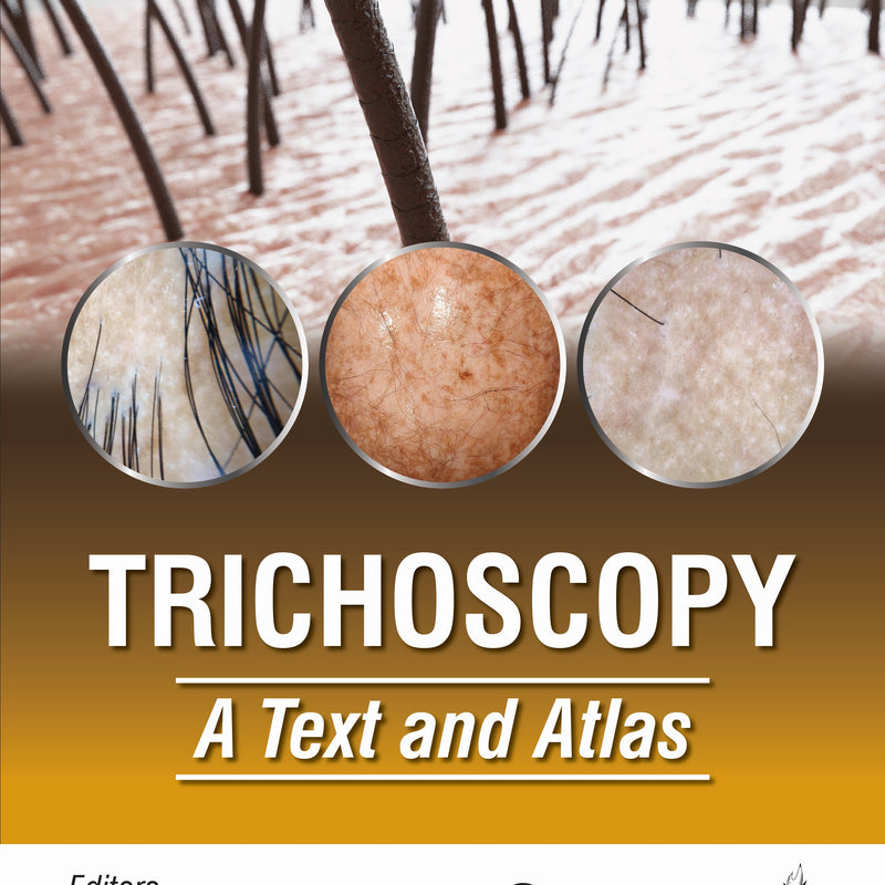 TRICHOSCOPY A TEXT AND ATLAS 2/E, 2025, SUBRATA MALAKAR