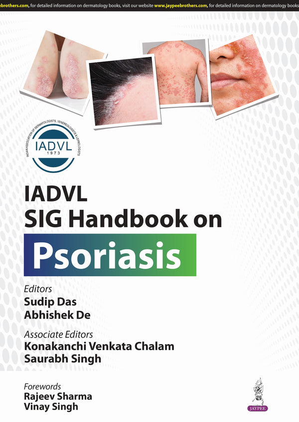 IADVL SIG HANDBOOK ON PSORIASIS 1/E, 2025, SUDIP DAS