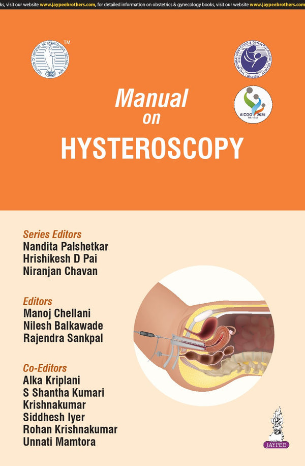 Manual on Hysteroscopy (AICOG 2025) by MANOJ CHELLANINILESH BALKAWADERAJENDRA SANKPALNANDITA PALSHETKARHRISHIKESH D PAINIRANJAN CHAVAN