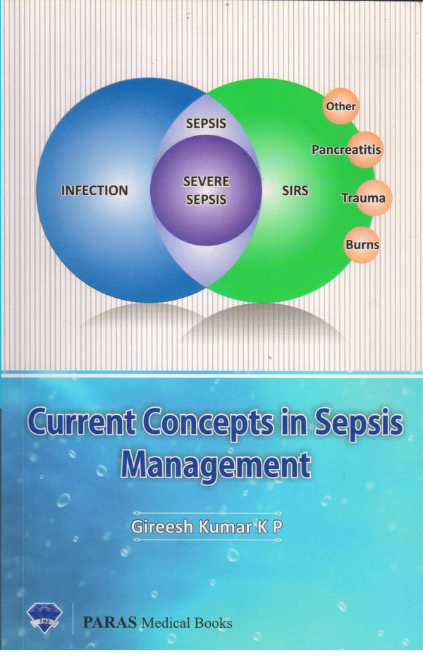 Current Concepts in Sepsis Management 1st/e by Gireesh Kumar K P