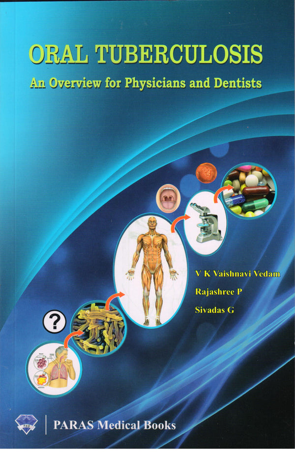Oral Tuberculosis An Overview for Physicians Dentists 1st/e by Vaishnavi Vedam