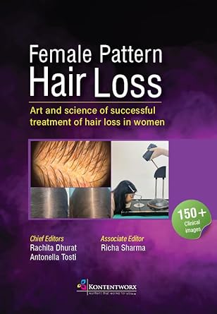 Female Pattern Hair Loss 1st/2024 by Rachita Dhurat, Antonella Tosti