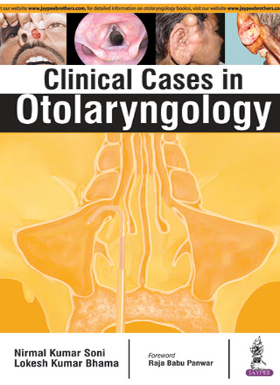 CLINICAL CASES IN OTOLARYNGOLOGY 1/E, 2016, NIRMAL KUMAR SONI