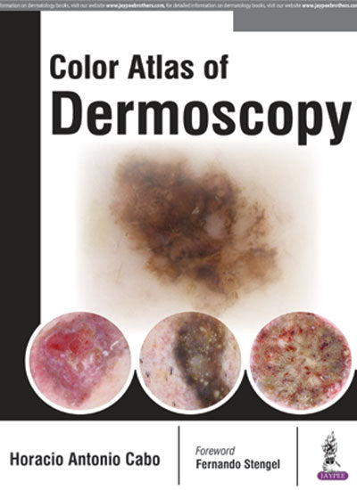 COLOR ATLAS OF DERMOSCOPY 1/E, 2017, HORACIO ANTONIO CABO