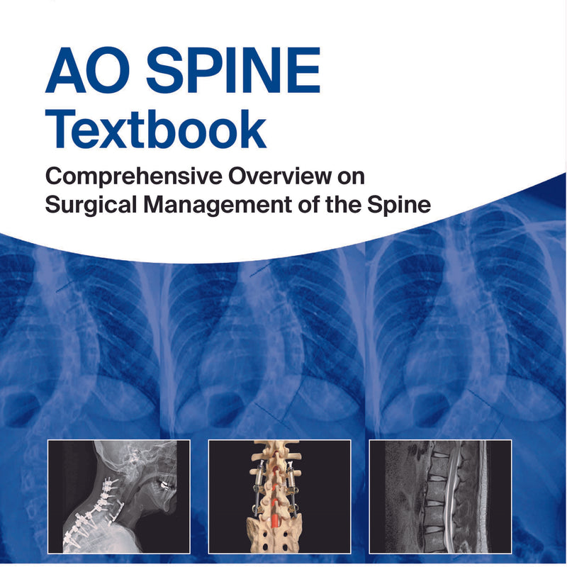 AO SPINE TEXTBOOK: COMPREHENSIVE OVERVIEW ON SURGICAL MANAGEMENT OF THE SPINE 1/E, 2020, MICHAEL P STEINMETZ