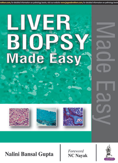 LIVER BIOPSY MADE EASY 1/E, 2017, NALINI BANSAL GUPTA
