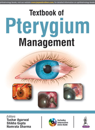 TEXTBOOK OF PTERYGIUM MANAGEMENT WITH DVD-ROM 1/E, 2017, TUSHAR AGARWAL