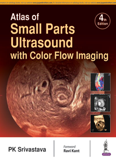 ATLAS OF SMALL PARTS ULTRASOUND WITH COLOR FLOW IMAGING 4/E, 2017, PK SRIVASTAVA