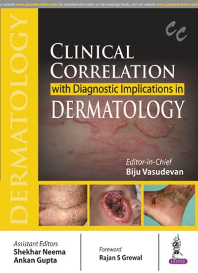 CLINICAL CORRELATION WITH DIAGNOSTIC IMPLICATIONS IN DERMATOLOGY 1/E, 2017, BIJU VASUDEVAN