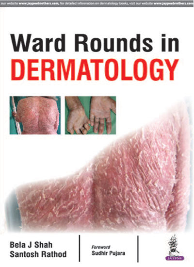WARD ROUNDS IN DERMATOLOGY 1/E, 2017, BELA J SHAH