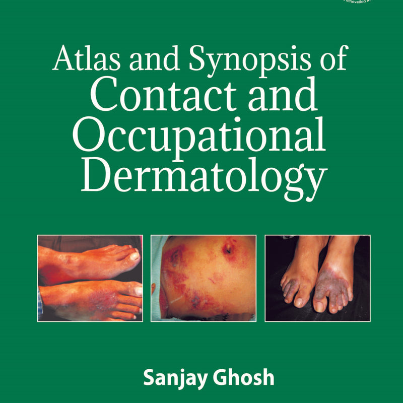 ATLAS AND SYNOPSIS OF CONTACT AND OCCUPATIONAL DERMATOLOGY 2/E, 2020, SANJAY GHOSH