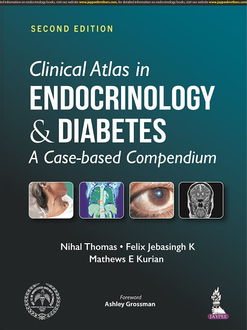 CLINICAL ATLAS IN ENDOCRINOLOGY & DIABETES: A CASE-BASED COMPENDIUM 2/E, 2022, NIHAL THOMAS