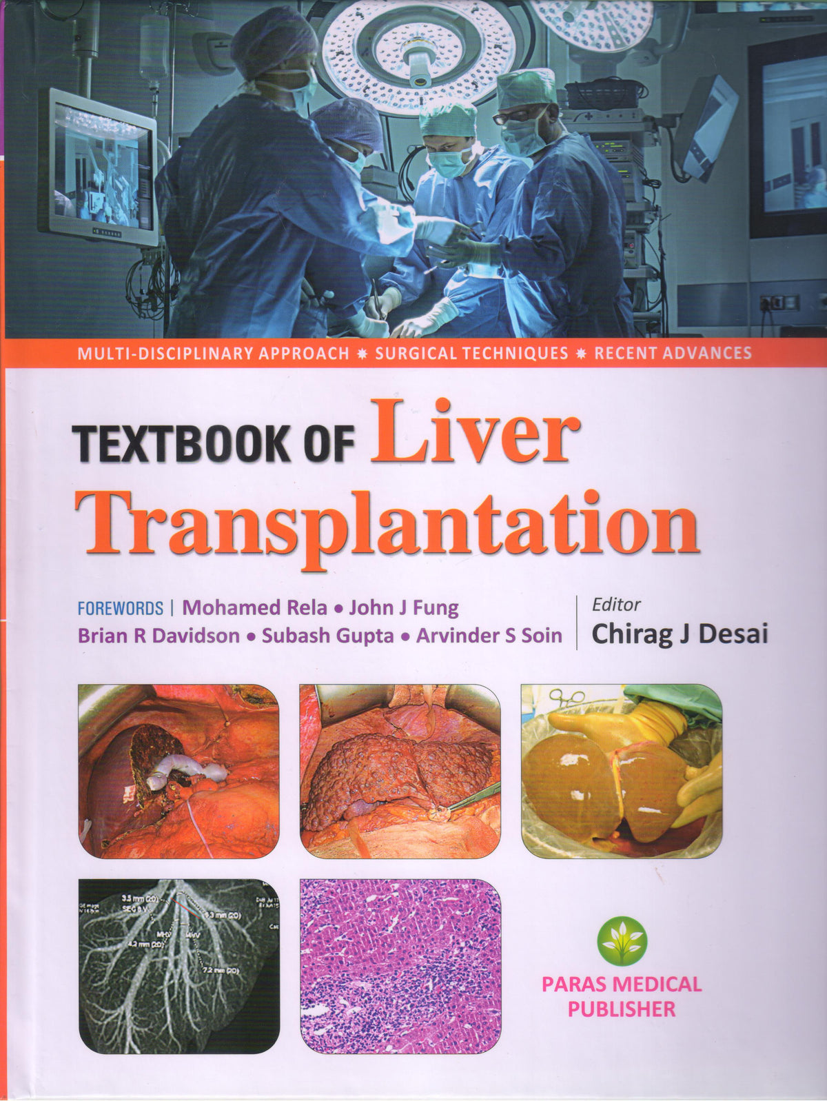 Textbook of Liver Transplantation 1st/2023
by 
Chirag J Desai