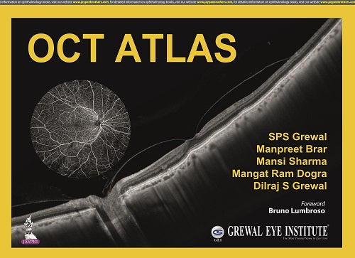OCT ATLAS,1/E,SPS GREWAL