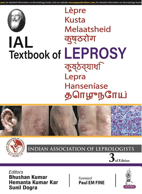 IAL TEXTBOOK OF LEPROSY, 3/E, by BHUSHAN KUMAR