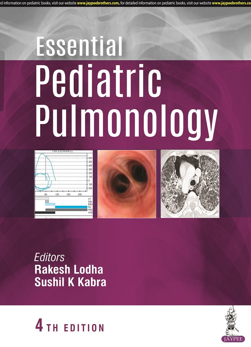 Essential Pediatric Pulmonology By Rakesh Lodha,