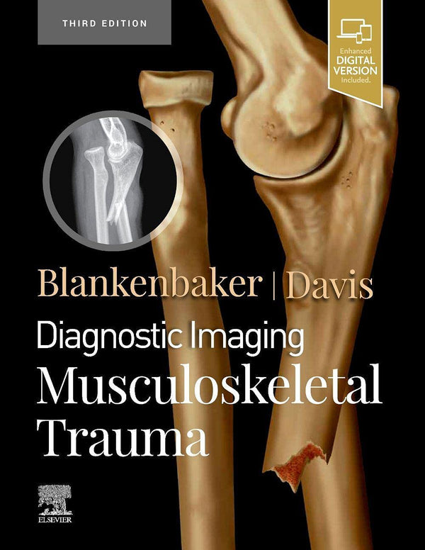 Diagnostic Imaging: Musculoskeletal Trauma:  3ed, Jong, Elaine