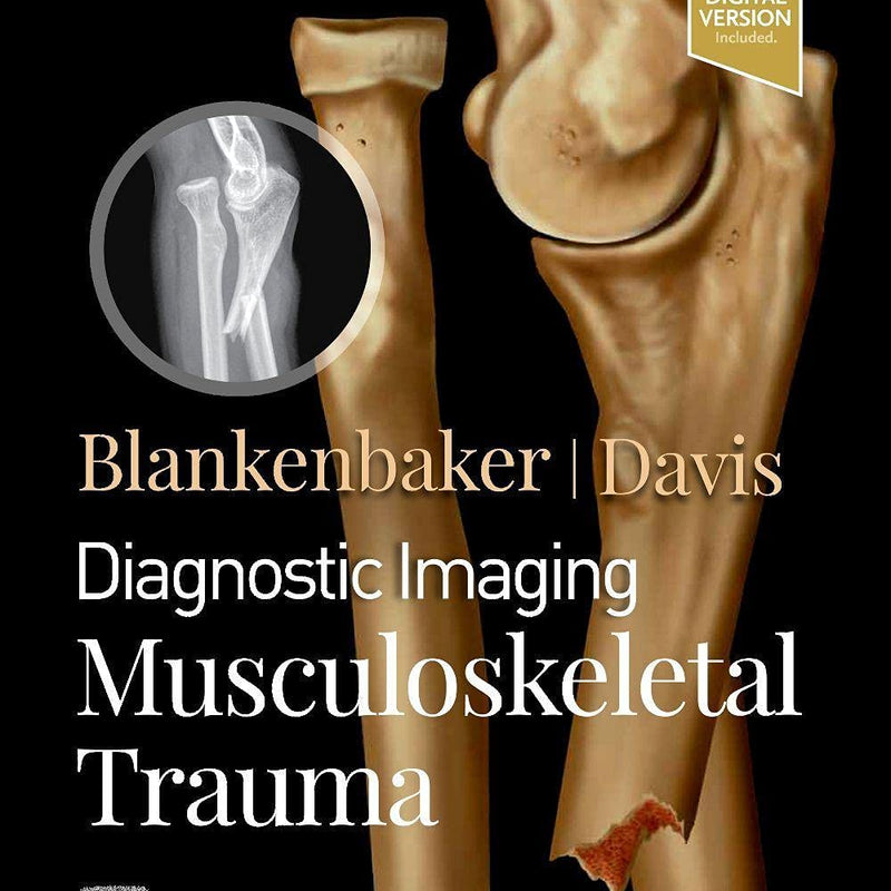 Diagnostic Imaging: Musculoskeletal Trauma:  3ed, Jong, Elaine