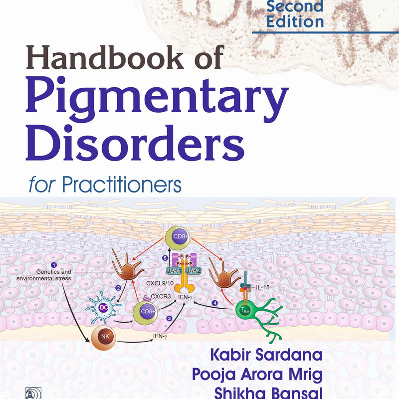 Handbook of Pigmentary Disorders for Practitioners, 2e (HB) by Sardana K.