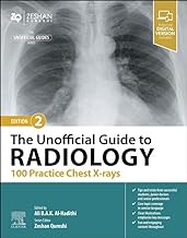 The Unofficial Guide to Radiology 100 Practice Chest X Rays 2nd/2024 by Ali B.A.K. Al-Hadithi