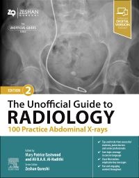 The Unofficial Guide to Radiology 100 Practice Abdominal X-rays 2nd/2024 by Mary Patrice Eastwood, Zeshan Aureshi