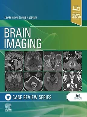 Brain Imaging Case Review Series 3rd/2024 by  Suyash Mohan