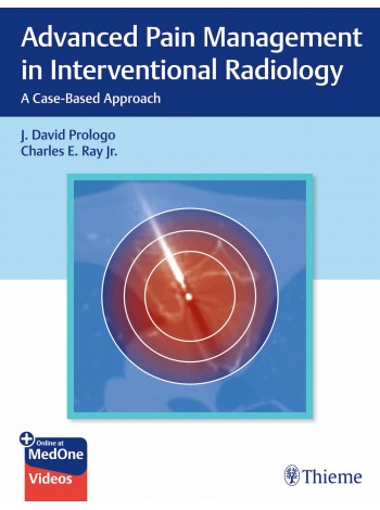 Advanced Pain Management in Interventional Radiology 1st/2024 by David Prologo, Charles Ray