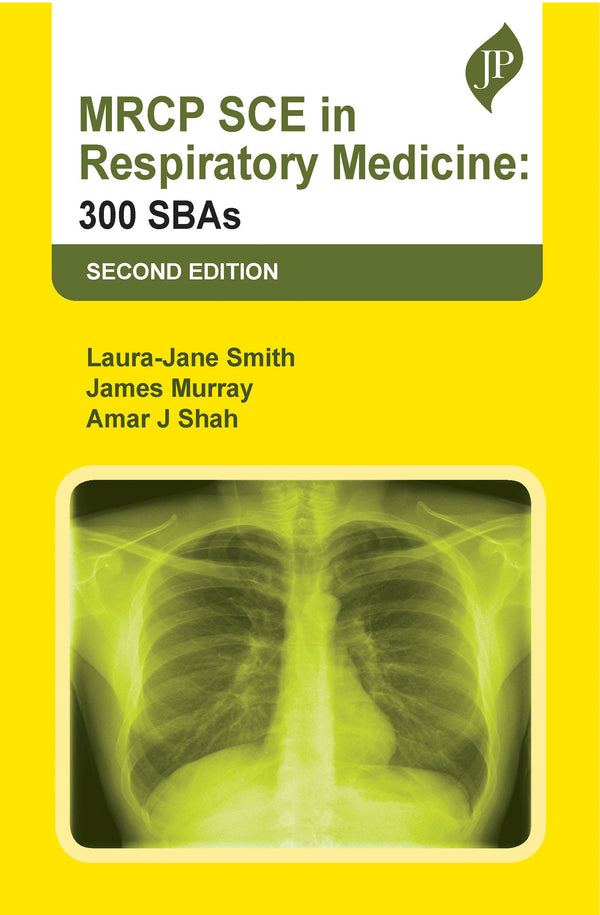 MRCP SCE IN RESPIRATORY MEDICINE: 300 SBAS 2/E, 2023, LAURA-JANE SMITH