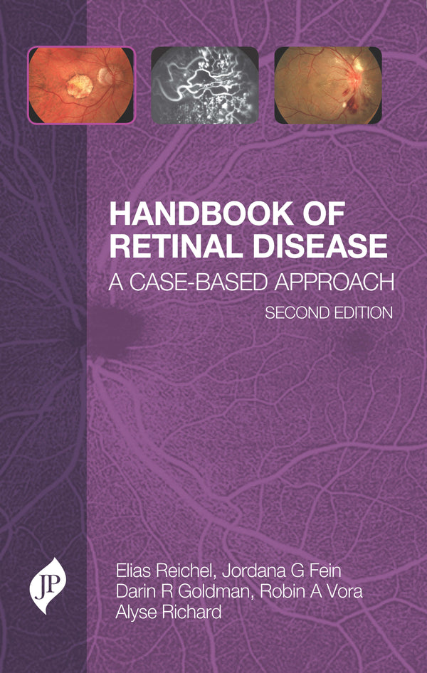 HANDBOOK OF RETINAL DISEASE: A CASE- BASED APPROACH, 2/E, BY, ELIAS REICHEL