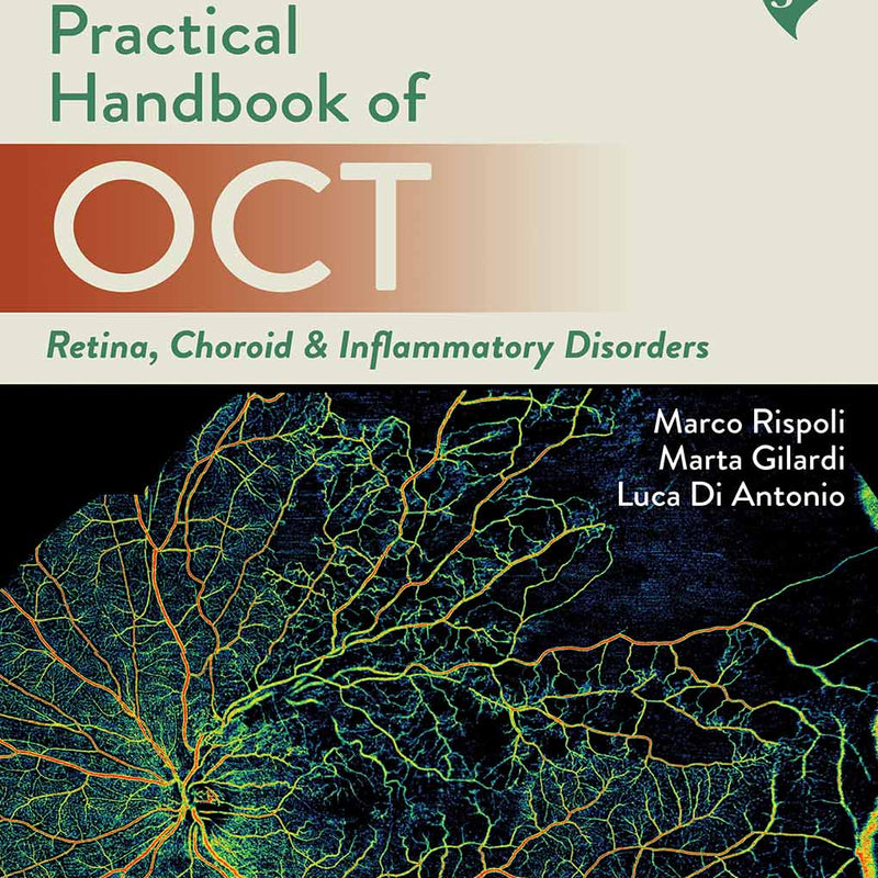 PRACTICAL HANDBOOK OF OCT RETINA, CHOROID & INFLAMMATORY DISORDERS, 4/E, MARCO RISPOLI