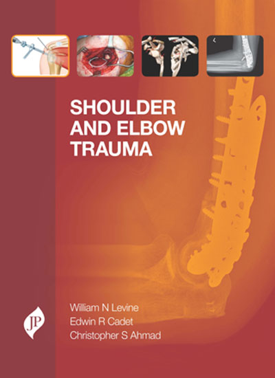 SHOULDER AND ELBOW TRAUMA 1/E, 2013, WILLIAM N. LEVINE